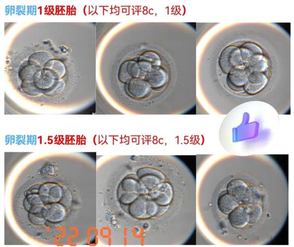 手把手揭秘沈阳试管助孕可以视频看胚胎吗