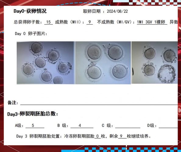 专业医生分析胚胎培养数据